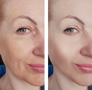 Anti-Aging for Women